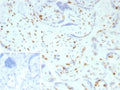 IHC staining of FFPE human placental tissue with p57Kip2 antibody (clone KIP2/7186). Inset: PBS used in place of primary Ab (secondary Ab negative control). HIER: boil tissue sections in pH 9 10mM Tris with 1mM EDTA for 20 min and allow to cool before testing.