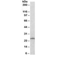 Western blot testing of A431 with RAN antibody at 0.5ug/ml. Predicted molecular weight ~25 kDa.