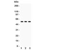 Western blot testing of PLTP antibody and 1. MCF7, 2. Raji and 3. HeLa lysate. Expected/observed size ~55KD