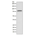 Western blot testing of human K562 cell lysate with 5-Lipoxygenase antibody. Predicted molecular weight ~78 kDa.