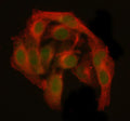 Immunofluorescent staining of GANP/MCM3AP using anti-MCM3AP antibody (green) and anti-Beta Tubulin antibody (red). GANP/MCM3AP was detected in immunocytochemical section of HELA cell. Enzyme antigen retrieval was performed using IHC enzyme antigen retrieval reagent for 15 mins. The cells were blocked with 10% goat serum. And then incubated with 5 ug/ml rabbit anti-MCM3AP antibody and mouse anti-Beta Tubulin antibody overnight at 4oC.