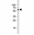 Western blot testing of Atg5 antibody at 1:4000 dilution + NIH3T3 lysate; ATG5: ~32 kDA; ATG5/ATG12 heterodimer: ~56 kDa