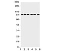 Western blot testing of PIAS1 antibody and Lane 1: rat testis; 2: mouse testis; 3: human HeLa; 4: (h) Jurkat; 5: (h) MCF-7; 6: (h) SKOV lysate; Expected size: 72~100KD
