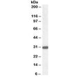 Western blot testing of human kidney lysate with NQO1 antibody at 0.03ug/ml. Predicted molecular weight ~30 kDa.