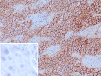 IHC staining of FFPE human tonsil tissue with Podoplanin antibody (clone D2-40). Inset: PBS used in place of primary Ab (secondary Ab negative control). HIER: boil tissue sections in pH 9 10mM Tris with 1mM EDTA for 20 min and allow to cool before testing.