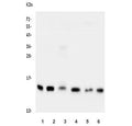 Western blot testing of human 1) PC-3, 2) Caco-2, 3) placenta, 4) A549, 5) COLO-320 and 6) HEK293 lysate with Cystatin C antibody. Predicted molecular weight ~16 kDa.