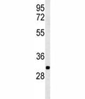 Western blot analysis of PGP antibody and K562 lysate