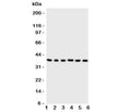 Western blot testing of Cdk7 antibody and Lane 1: rat testis; 2: rat ovary; 3: HeLa; 4: MCF-7; 5: A549; 6: COLO320 cell lysate. Predicted molecular weight: ~37kDa.