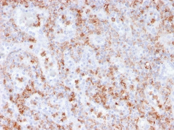 IHC staining of FFPE human spleen with recombinant S100A9 antibody (clone rMAC3781). HIER: boil tissue sections in pH 9 10mM Tris with 1mM EDTA for 20 min and allow to cool before testing.