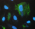 Immunofluorescent staining of FFPE human A431 cells with SCNN1A antibody (green) and DAPI nuclear stain (blue). HIER: steam section in pH6 citrate buffer for 20 min.
