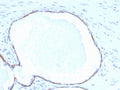 IHC staining of FFPE human prostate tissue with Cytokeratin 14 antibody (clone KRT14/4132). HIER: boil tissue sections in pH 9 10mM Tris with 1mM EDTA for 20 min and allow to cool before testing.