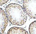 IHC analysis of RBBP6 using anti-RBBP6 antibody. RBBP6 was detected in a paraffin-embedded section of rat testis tissue. Heat mediated antigen retrieval was performed in EDTA buffer (pH 8.0, epitope retrieval solution). The tissue section was blocked with 10% goat serum. The tissue section was then incubated with 2 ug/ml rabbit anti-RBBP6 antibody overnight at 4oC. Peroxidase Conjugated Goat Anti-rabbit IgG was used as secondary antibody and incubated for 30 min at 37oC.