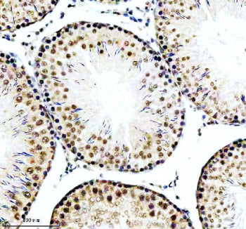 IHC analysis of RBBP6 using anti-RBBP6 antibody. RBBP6 was detected in a paraffin-embedded section of rat testis tissue. Heat mediated antigen retrieval was performed in EDTA buffer (pH 8.0, epitope retrieval solution). The tissue section was blocked with 10% goat serum. The tissue section was then incubated with 2 ug/ml rabbit anti-RBBP6 antibody overnight at 4oC. Peroxidase Conjugated Goat Anti-rabbit IgG was used as secondary antibody and incubated for 30 min at 37oC.