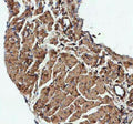 IHC staining of FFPE mouse heart tissue with Actin antibody. HIER: Boil the paraffin sections in pH8 EDTA buffer for 20 minutes and allow to cool prior to staining.