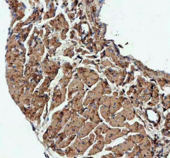 IHC staining of FFPE mouse heart tissue with Actin antibody. HIER: Boil the paraffin sections in pH8 EDTA buffer for 20 minutes and allow to cool prior to staining.