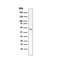 Western blot testing of human HCT-116 cell lysate with recombinant CK8 antibody (clone rB22.1).