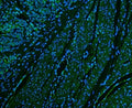Immunofluorescent staining of FFPE human colon cancer with CD39 antibody (green) and DAPI nuclear stain (blue). HIER: steam section in pH6 citrate buffer for 20 min.