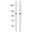 Western blot testing of 1) human skeletal muscle and 2) mouse skeletal muscle with CLCN1 antibody at 1:2000. Predicted molecular weight ~109 kDa.