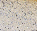 IHC staining of FFPE mouse brain tissue with Histidine decarboxylase antibody. HIER: boil tissue sections in pH8 EDTA for 20 min and allow to cool before testing.