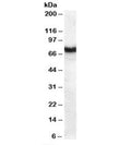 Western blot testing of human pancreas lysate with Frizzled 8 antibody at 1ug/ml. Predicted molecular weight: ~73kDa.