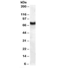 Western blot testing of human pancreas lysate with Frizzled 8 antibody at 1ug/ml. Predicted molecular weight: ~73kDa.