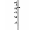 Western blot analysis of Keratin-14 antibody and mouse NIH3T3 lysate.