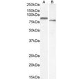 Western blot testing of A) human placenta and B) mouse kidney tissue lysate with Transglutaminase 2 antibody. Predicted molecular weight: ~78 kDa.