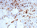 IHC staining of FFPE human lymph node tissue with Topoisomerase II alpha antibody (clone TOP2A/8103R). HIER: boil tissue sections in pH 9 10mM Tris with 1mM EDTA for 20 min and allow to cool before testing.