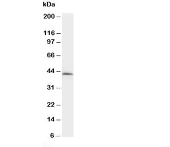 Western blot testing of NPHS2 antibody and rat kidney tissue lysate. Predicted molecular weight ~42kDa.