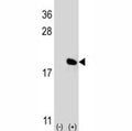 Western blot analysis of IL-17 antibody and 293 cell lysate (2 ug/lane) either nontransfected (Lane 1) or transiently transfected (2) with the IL17A gene. Expected molecular weight: 15-20 kDa (monomer), 30-40 kDa (homodimer), depending on glycosylation level.