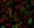 Immunofluorescent staining of human Raji cells with CD20 antibody (clone CDLA20-1, green) and Reddot nuclear stain (red).