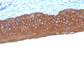 IHC staining of FFPE human tonsil tissue with Pan Cytokeratin antibody (clone MonoPoly/4999R). HIER: boil tissue sections in pH 9 10mM Tris with 1mM EDTA for 20 min and allow to cool before testing.