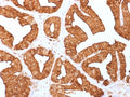 IHC staining of FFPE human prostate with Annexin A1 antibody (clone ANXA1/1671). HIER: boil tissue sections in pH6, 10mM citrate buffer, for 10-20 min and allow to cool before testing.