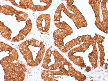 IHC staining of FFPE human prostate with Annexin A1 antibody (clone ANXA1/1671). HIER: boil tissue sections in pH6, 10mM citrate buffer, for 10-20 min and allow to cool before testing.