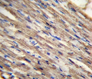 ACSM6 antibody analysis in formalin fixed and paraffin embedded human heart tissue.