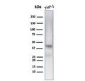 Western blot testing of human THP-1 cell lysate with Wilms Tumor 1 antibody (clone WT1/7451). Expected molecular weight 47-55 kDa.