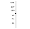 Western blot testing of human SK-BR-3 cell lysate with Espin antibody. Predicted molecular weight ~92 kDa; isoforms can be observed at ~110 kDa and ~30 kDa.
