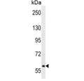 Western blot testing of human NCI-H292 cell lysate with TEC antibody. Expected molecular weight: 58-73 kDa (multiple isoforms).