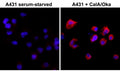 ICC of serum-starved human A431 cells non-treated or treated with Calyculin A/Okadaic Acid, using the recombinant Phosphothreonine antibody at 1:500 (PE-secondary, red) and DAPI (blue).