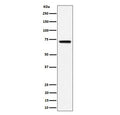 Western blot testing of human Raji cell lysate with BLNK antibody. Predicted molecular weight: ~51 kDa but can be observed at 65-70 kDa.