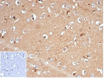 IHC staining of FFPE human brain tissue with recombinant AKR1B1 antibody (clone AKR1B1/7009R) at 2ug/ml in PBS for 30 min RT. Negative control inset: PBS used instead of primary antibody to control for secondary Ab binding. HIER: boil tissue sections in pH 9 10mM Tris with 1mM EDTA for 20 min and allow to cool before testing.