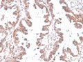 IHC staining of FFPE human ovary with GDF9 antibody. HIER: boil tissue sections in pH 9 10mM Tris with 1mM EDTA for 20 min and allow to cool before testing.