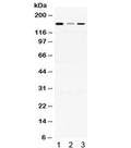 Western blot testing of 1) rat brain, 2) mouse liver and 3) human HepG2 lysate with ADAMTS13 antibody at 0.5ug/ml. Predicted/observed molecular weight ~154 kDa.