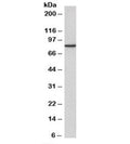 Western blot testing of A431 cell lysate with Gamma Catenin antibody at 2ug/ml. Predicted molecular weight ~82kDa. An NAP blocker was used in place of non-fat milk as blocking solution and diluent. (1)