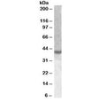 Western blot testing of nuclear HeLa lysate with XBP1 antibody at 1ug/ml. Predicted molecular weight ~40 kDa (isoform 2). (1)
