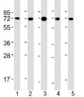 Western blot testing of human 1) MCF-7, 2) PC-3, 3) COS-7, 4) DU-145 and 5) SK-BR-3 cell lysate with USP2 antibody at 1:2000. Predicted molecular weight: 68 kDa. Isoforms at ~41 and ~45 kDa may also be observed.