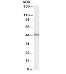Western blot testing of human liver lysate with ACAT1 antibody at 0.01ug/ml. Predicted molecular weight: ~45kDa.