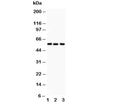 Western blot testing of Alkaline Phosphatase antibody and Lane 1: human placenta; 2: HT1080; 3: Jurkat. Predicted molecular weight ~57 kDa, but can be observed at up to ~75 kDa due to glycosylation.