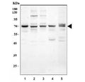 Western blot testing of 1) human HepG2, 2) human HeLa, 3) human A549, 4) rat heart and 5) mouse heart tissue lysate with GRK5 antibody. Expected molecular weight ~68 kDa.