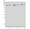 Western blot testing of 1) rat brain, 2) rat liver, 3) rat heart, 4) rat kidney, 5) mouse brain, 6) mouse liver, 7) mouse heart and 8) mouse kidney tissue lysate with CLCN5 antibody. Expected molecular weight: 80-83 kDa (isoform 2) and 90-100 kDa (isoform 1).